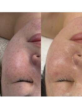 ウィンウィン 新山口店(Win Win)/お肌の土台を整える