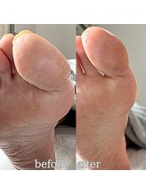 フットミー(foot mii)/