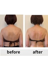 ティアラ/before after　