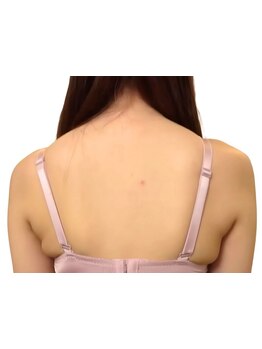 二の腕・ハミ肉ケアをしたい