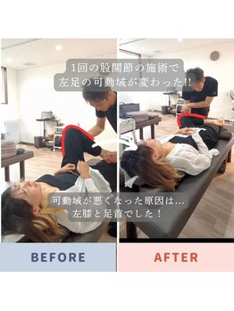 きき接骨院整体院 多賀城中野栄院/1回の施術で動きやすさ実感