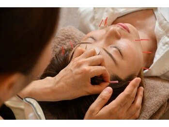 どんぐり鍼灸院 接骨院/ 【美容鍼】