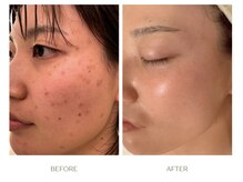 ボンクール(BONCOEUR)の雰囲気(途中経過(S様30代・施術6回/期間3ヶ月))