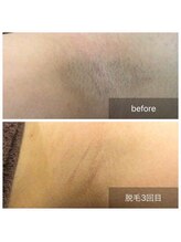 アネル 浦添店(anel)/