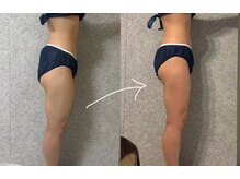 ラティエンヌ(Latienne)の雰囲気（太もものハリを無くし、ヒップアップも叶う♪）