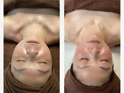 ル・ティアレの写真