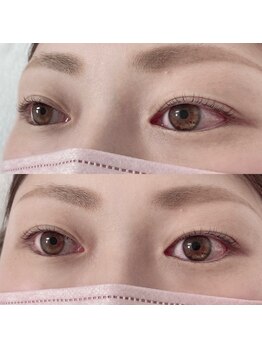 リボーテ(Reboaute)/アップフォースリフト