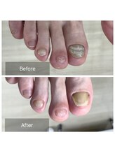 ドクターネイル爪革命 北千住店/トータルフットケア