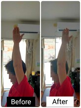 アース エンジェル整体院/ビフォアフ　肩こり　ストレッチ