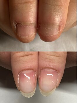 クウ(KUU)の写真/むしり癖等トラブルでお悩みの爪に◎深爪矯正メニューや丁寧な付け替え技術、ネイルケアでお悩み解消へ◇