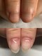 クウ(KUU)の写真/むしり癖等トラブルでお悩みの爪に◎深爪矯正メニューや丁寧な付け替え技術、ネイルケアでお悩み解消へ◇