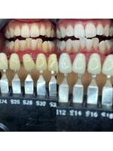 トウキョウスワーズ 池袋店(TOKYO SWRS)/#ホワイトニング #池袋 #渋谷