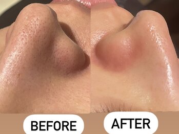 ソーレエルーナ(SOLE e LUNA)