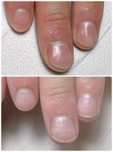 スマイルニコ(smile nico)/自爪育成で土台が育だつ！