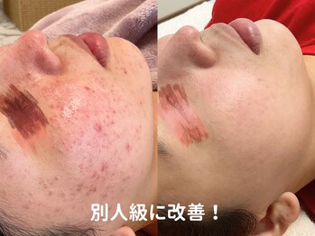 ココマヒナ(coco de mahina)/肌質から変わります