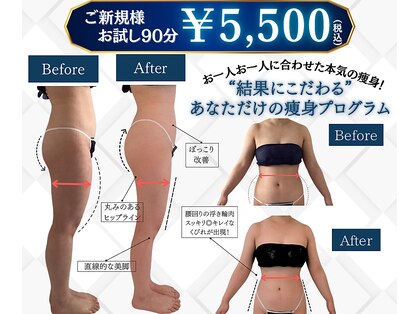 セロ(Sero)の写真