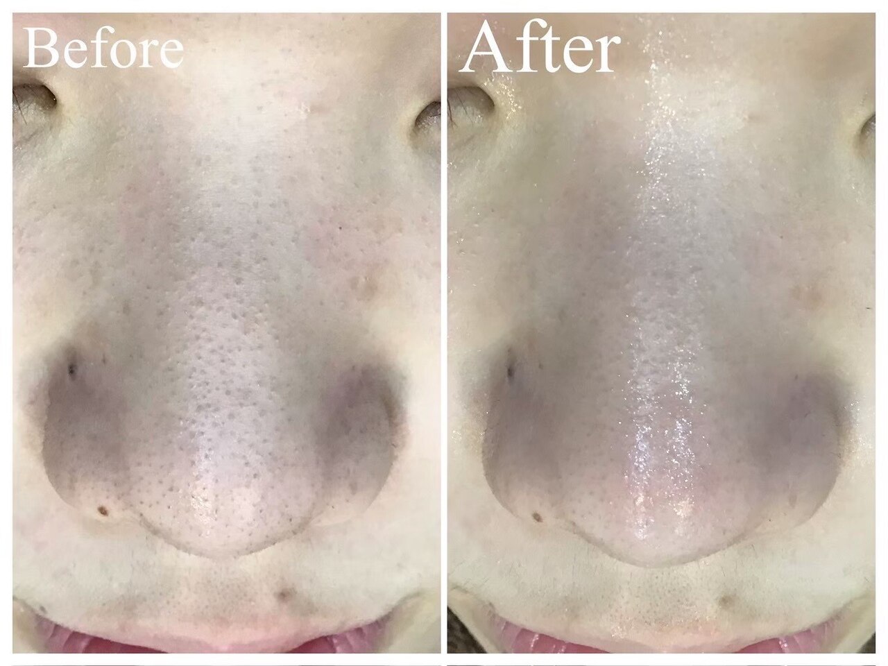 津市で毛穴ケアが人気のエステサロン｜ホットペッパービューティー