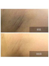 アネル 浦添店(anel)/