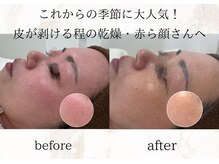 ソワン ドゥ シャルマン(soin de charmant)