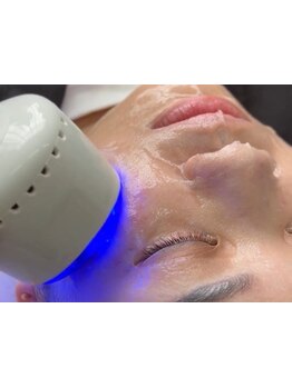 美白ケアをしたい