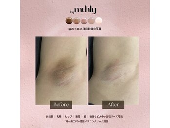 モア(more.)/脇の変化(一回)