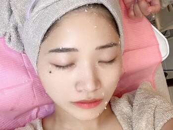 エイミー(Amy)の写真/年齢によるくすみをケア!骨と肌の同時ケアで、10年前の透明感へ。本格コルギ×最新ピーリングの融合