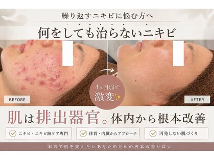 アエオボンヌール(A.E.O BONHEUR)の写真