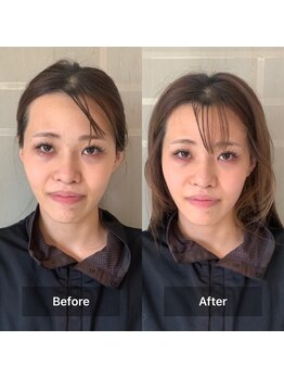 ヨサ パーク コアハート(YOSA PARK CORE HEART)/超音波ミスト