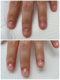 爪噛み改善ケア11000(オイル付き