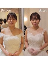 ルーム(Looom)/Before After