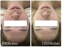 ルルボーテ(Loulou Beaute)/クリスティーナ／アンストレス