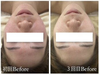 ルルボーテ(Loulou Beaute)/クリスティーナ/アンストレス