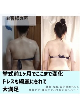 エルバード/ブライダル背中・スッキリ最速！