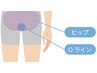 【メンズ脱毛/VIOH脱毛】[ニオイ改善] VIOH脱毛/VIO全体＋ヒップ 10900→8900