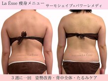 ラエッセ(La Esse)/姿勢改善・背中すっきり