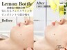 二重顎フェイスライン特化!レモンボトル脂肪分解で速攻小顔◎