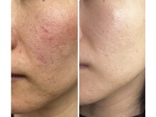 ミミルーチェ(mimiluce)の雰囲気（肌質改善に特化してる若よもぎ蒸しを完備◎普通のよもぎではない）