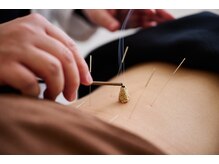 ふうき堂/鍼灸施術