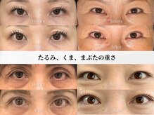 アストリエ グレース 相模大野(Astorie Grace)/目元エステ｜Before→After