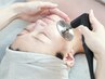 6週間以内【早めのケアで効果UP】インディバ30分¥6,000