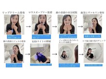 ホワイトニングショップ 長崎店/【セルフホワイトニングの手順】