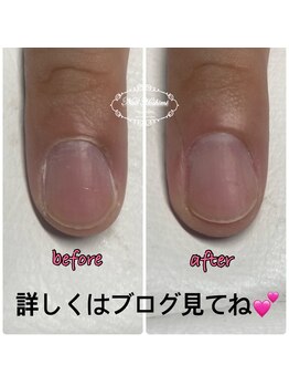 ジュジュ(Juju)/ネイルケア