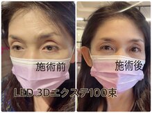 メルシーアイ アカナベテン(Merci Eye 茜部店)の雰囲気（LED 3Dボリュームラッシュ100束の施術Before After）