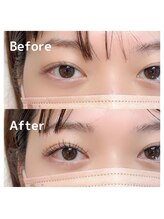 アイル バイ ストーク(I’LL by STOKED)/