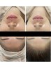 【肌質でお悩みの方！効果実感】貴方だけの最適フェイシャル＆肩こりスッキリ