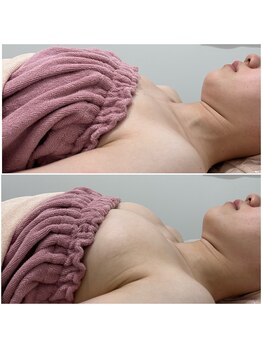 ビューティーサロン シンデレラ 心斎橋本店(Cinderella)/シンデレラバスト　20代前半