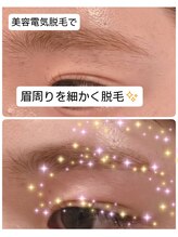 ベビースキン(baby skin)/美容電気脱毛