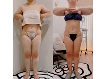 エクリア(Eclia)/最短で変化を実感