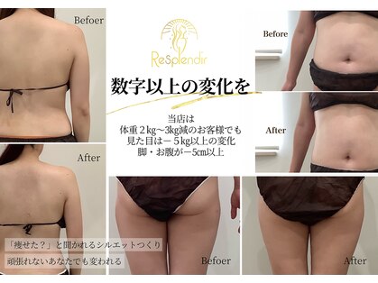 レスプロンディール(Resplendir)の写真