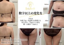 レスプロンディール(Resplendir)